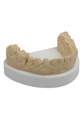 RockStar® gold 5 kg.png