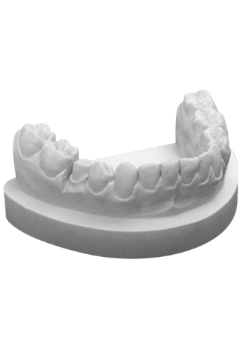 RockStar® light grey 5 kg.png