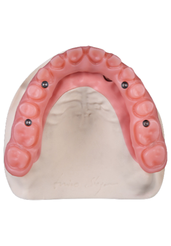 Denture Gingiva - 95 opis.png