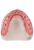 Denture Gingiva - 95 opis.png